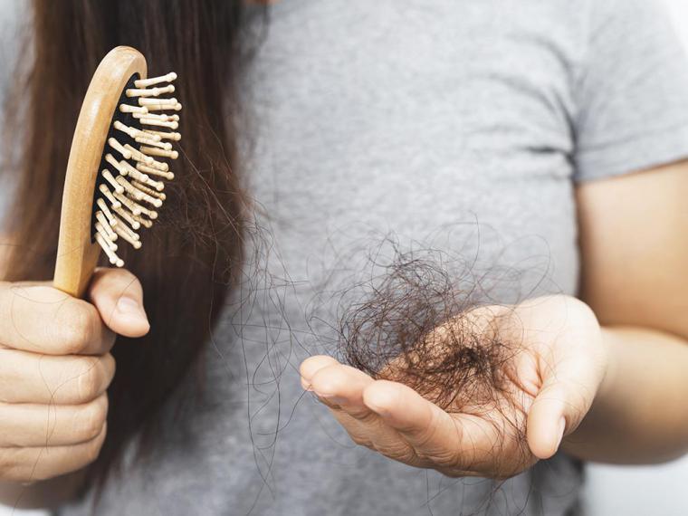 Caída del cabello en otoño: ¿cuándo debo alarmarme?
 